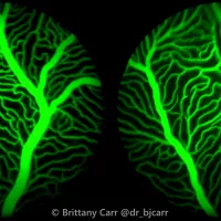 angiography of retina